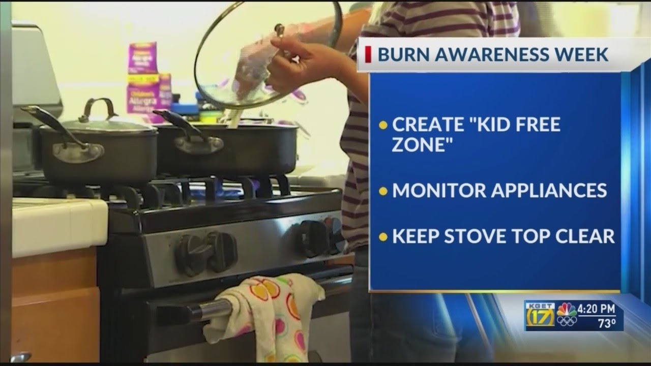 Burn Awareness Week: Tips to prevent burns at home