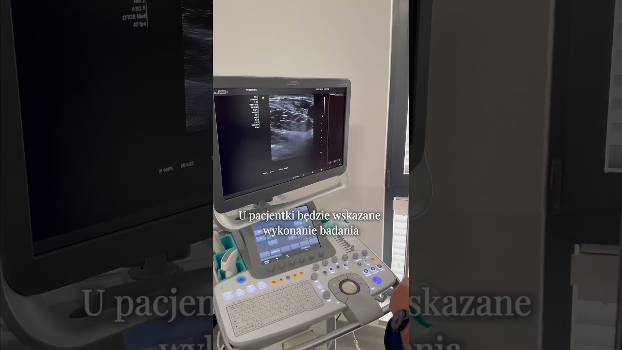 1 etap badania flebologicznego #badanie #usg #usgdoppler #żylaki #flebolog #flebologia