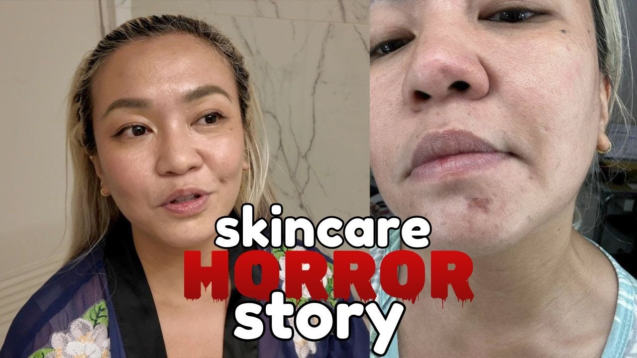 MY SKINCARE HORROR STORY! WAG NA WAG NYO TONG GAGAWIN..