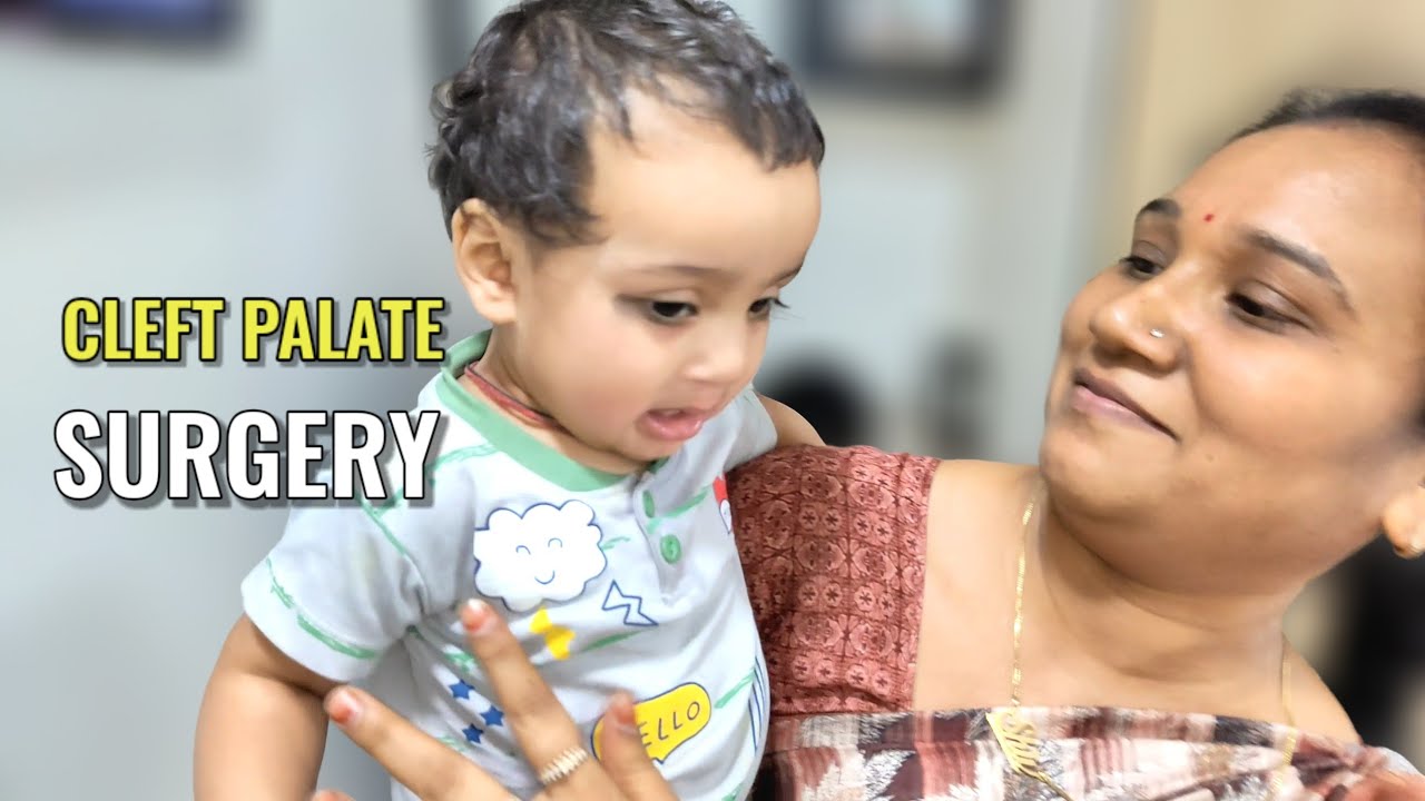 Things Parents Must Know About Cleft Palate Surgery | Dr Parit Ladani