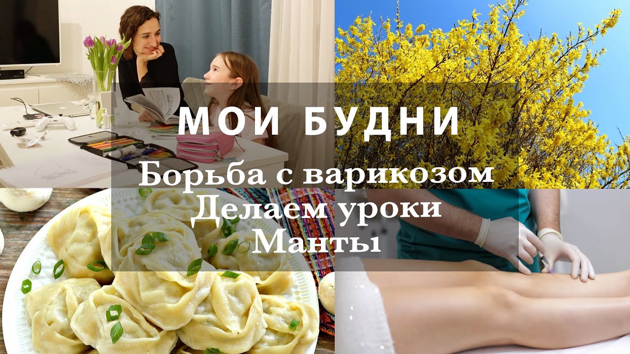 МОИ БУДНИ. ВАРИКОЗ И НОВАЯ СКЛЕРОТЕРАПИЯ. ГОТОВЛЮ МАНТЫ. ДЕЛАЕМ УРОКИ. ЛЮБИМЫЕ СЛАДОСТИ. ВЛОГ