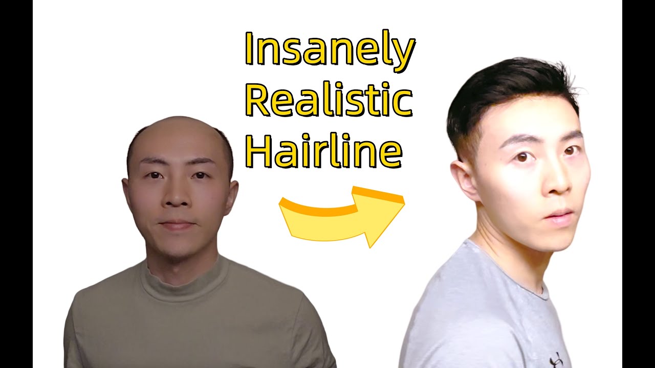 This Hair System Has an INSANELY Real Hairline