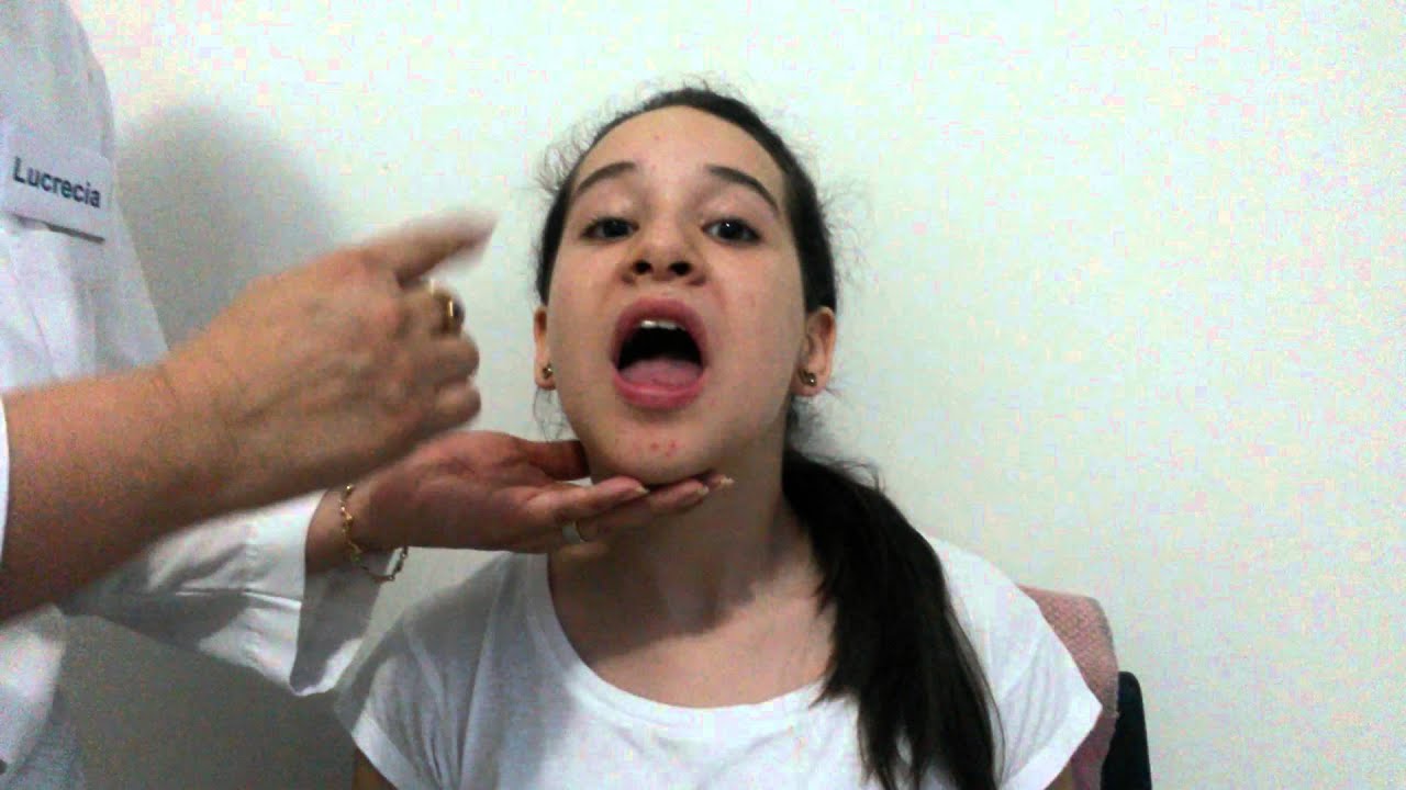 Examen Neurologico