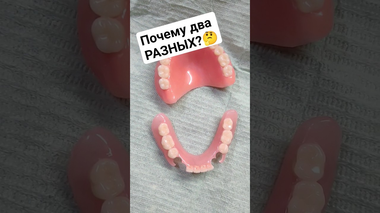 Акрил + Акри-Фри?! #съёмныепротезы #зубныепротезы #съёмныезубныепротезы #протезирование