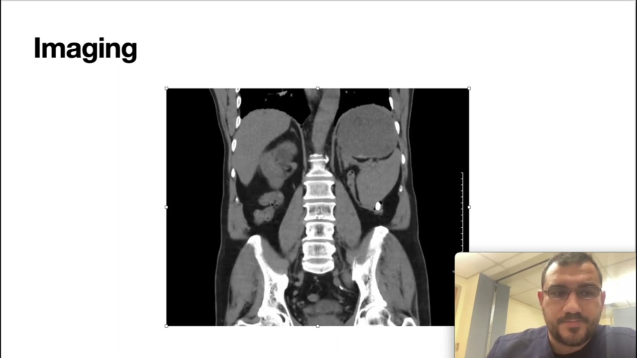 Internal Medicine Quick Cases-1 (Gastric outlet obstruction)