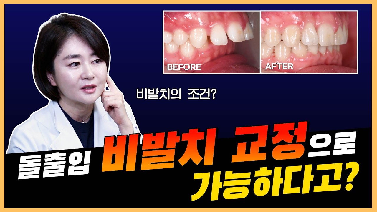 돌출입, 꼭 발치해야 할까? 비발치 교정 가능한 경우 알려드립니다👀