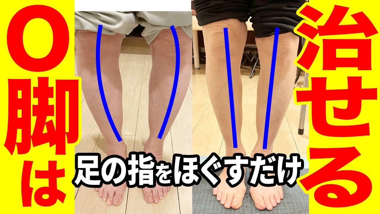 【膝痛にも効果抜群】O脚の原因は足指にあり！自分でO脚改善するセルフケア｜変形性膝関節炎｜足指ほぐし｜鍼灸整体院リーフ