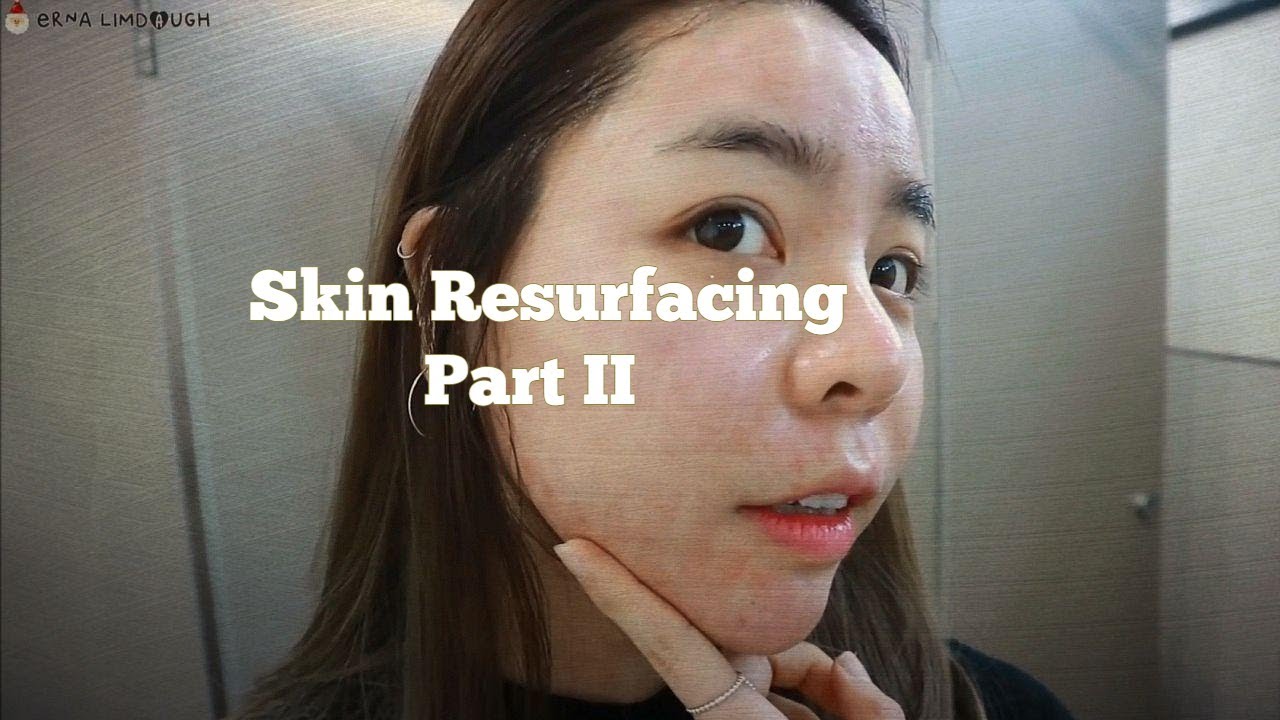 Venus Viva Skin Resurfacing Part 2 | Erna Limdaugh
