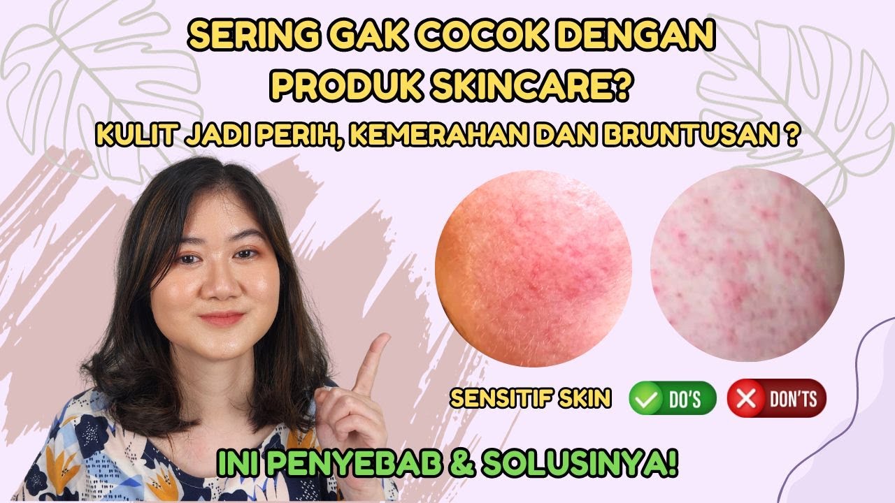 TIPS SKINCARE UNTUK KULIT SENSITIF DAN CARA MENEMUKAN SKINCARE YANG COCOK