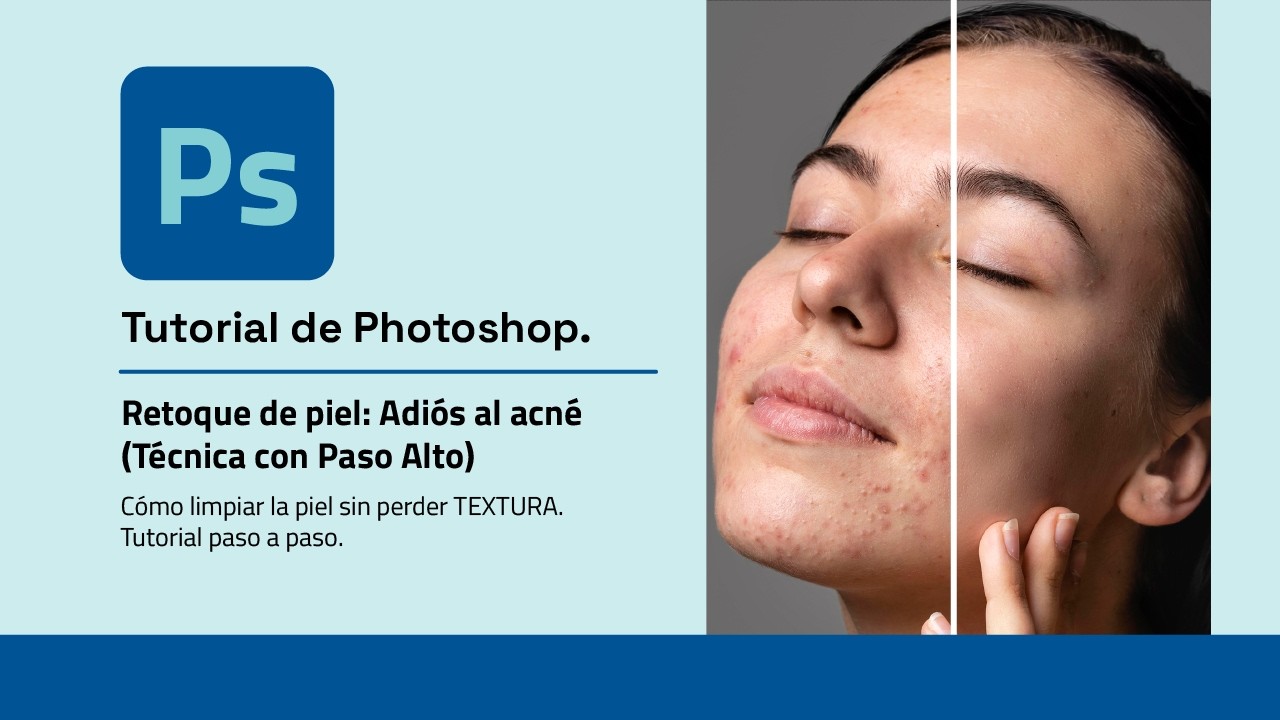 Retoque de PIEL PROFESIONAL: Adiós al Acné (Técnica Paso Alto) #photoshop #tutorial #acne #limpieza