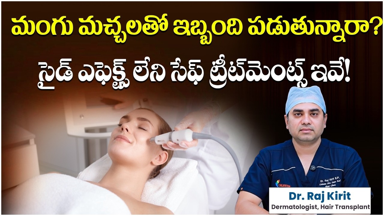 మంగు మచ్చలు ఎందుకు వస్తాయి | Best and Effective Treatments for Melasma | Celestee Skin & Hair Clinic