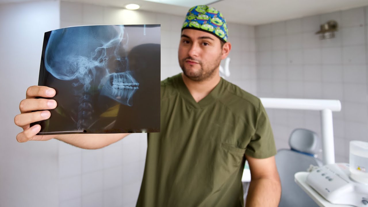 LA RADIOGRAFÍA MÁS IMPORTANTE DE TU TRATAMIENTO DE ORTODONCIA 🔥 ¿DIENTES VOLADOS CON BRACKETS?