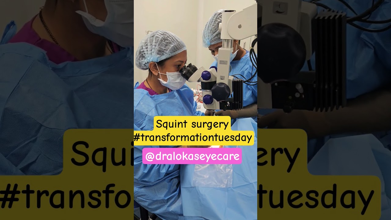 #tranformation is on! Squint surgery saves vision!#eyecare #squint
