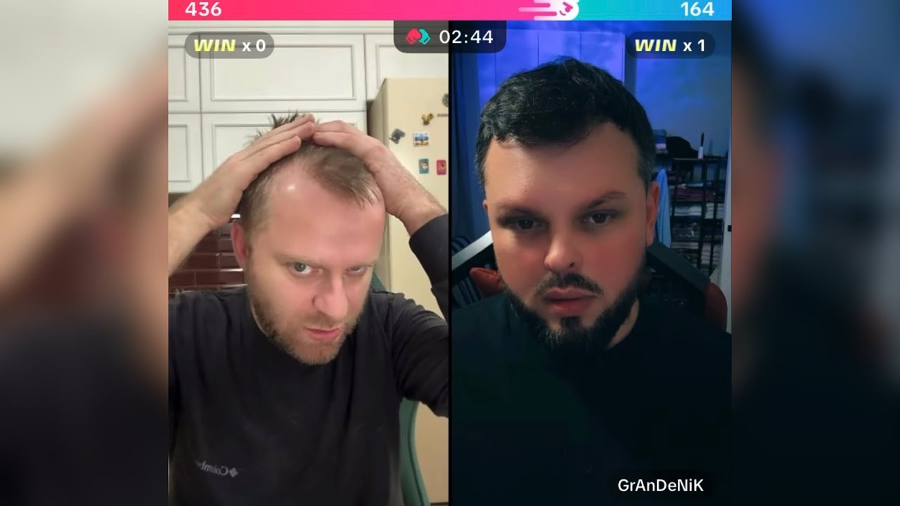 ОТ СТРЕССА ВСЕ ВОЛОСЫ ВЫПАЛИ, НУЖНА СРОЧНО ПЕРЕСАДКА!