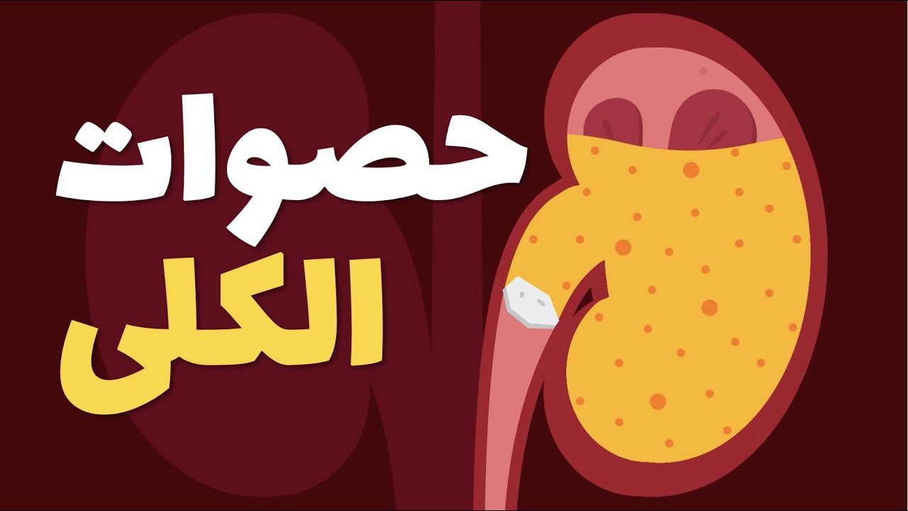 آلام الكلى - كيفية علاج حصوات الكلى؟ الأسباب والأعراض
