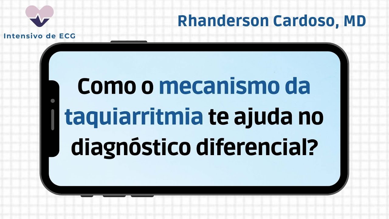 Mecanismos de taquiarritmias