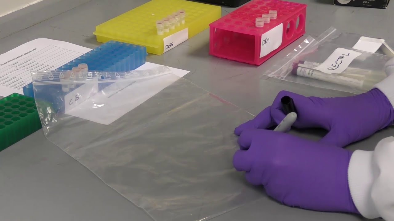 Preparation of collection bags for the LAKANA trial