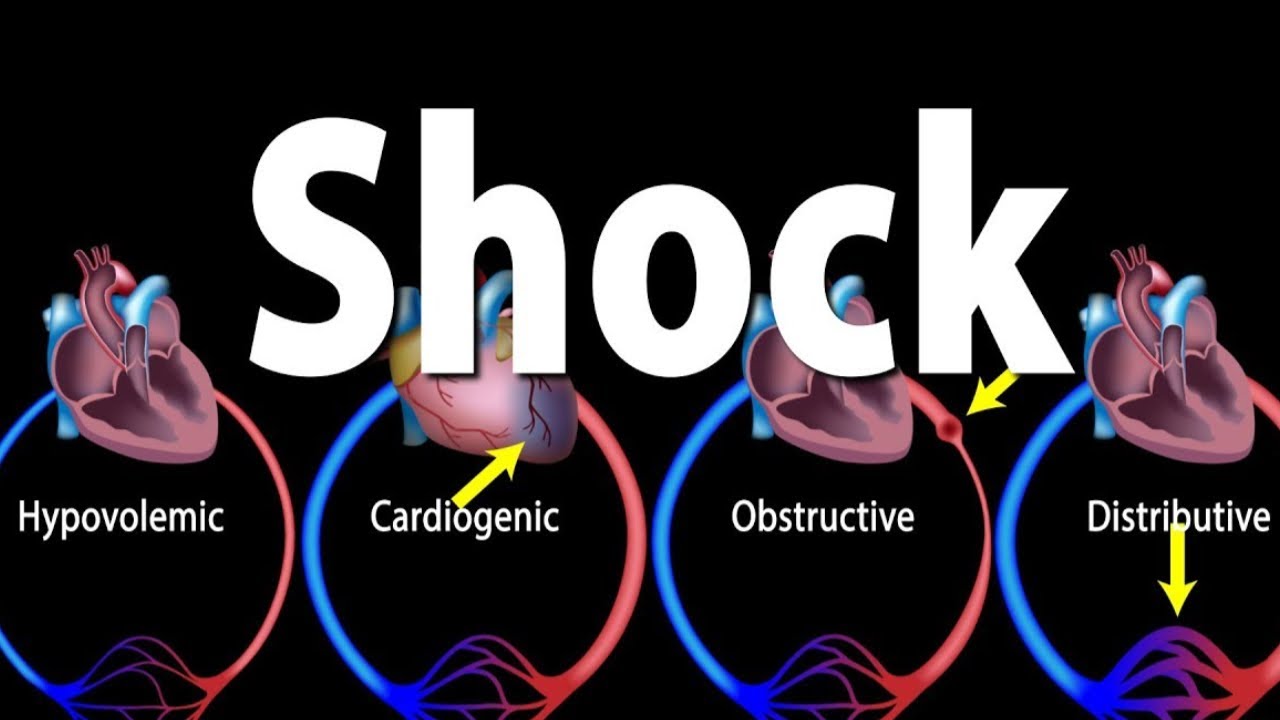 Tipos de Shock Resumido Qx Medic