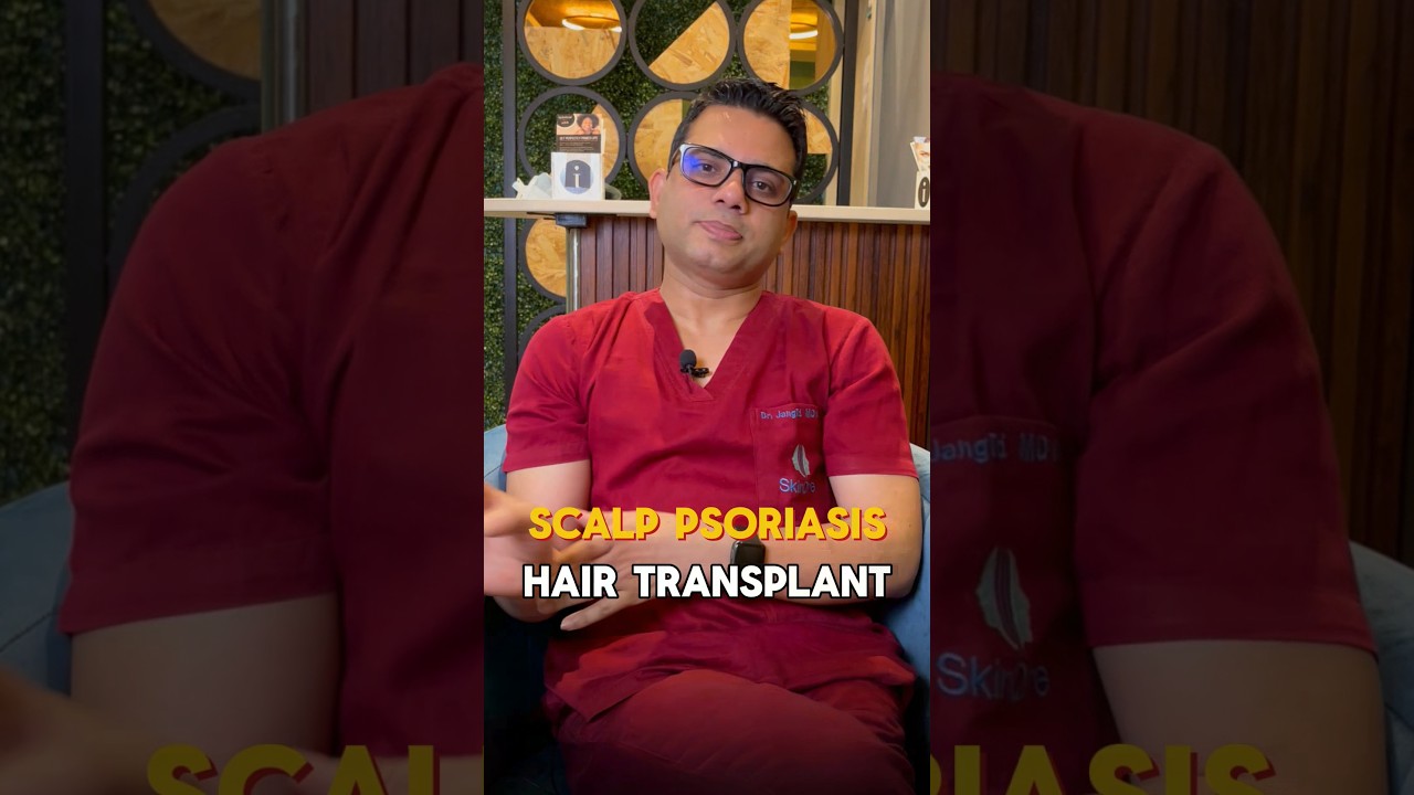 Hair Transplant in Scalp Psoriasis ? | Learn from the hair transplant surgeon | #shorts