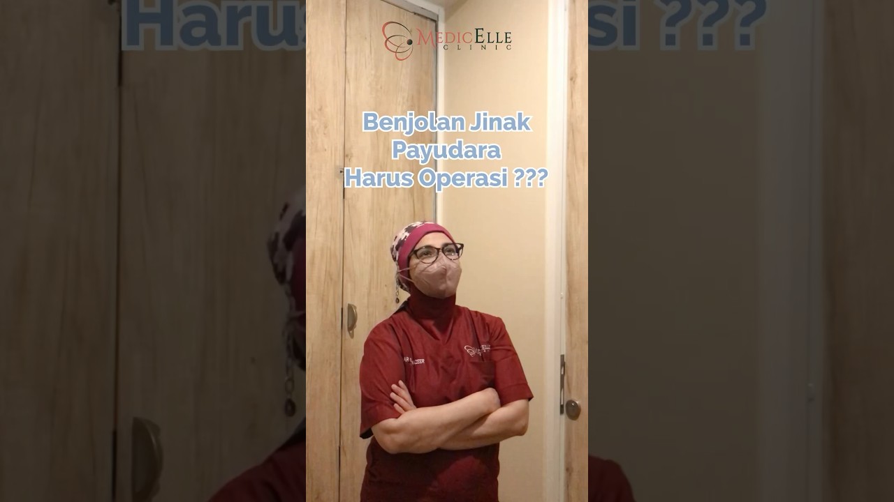 Benjolan Jinak Payudara Tidak Harus Operasi !