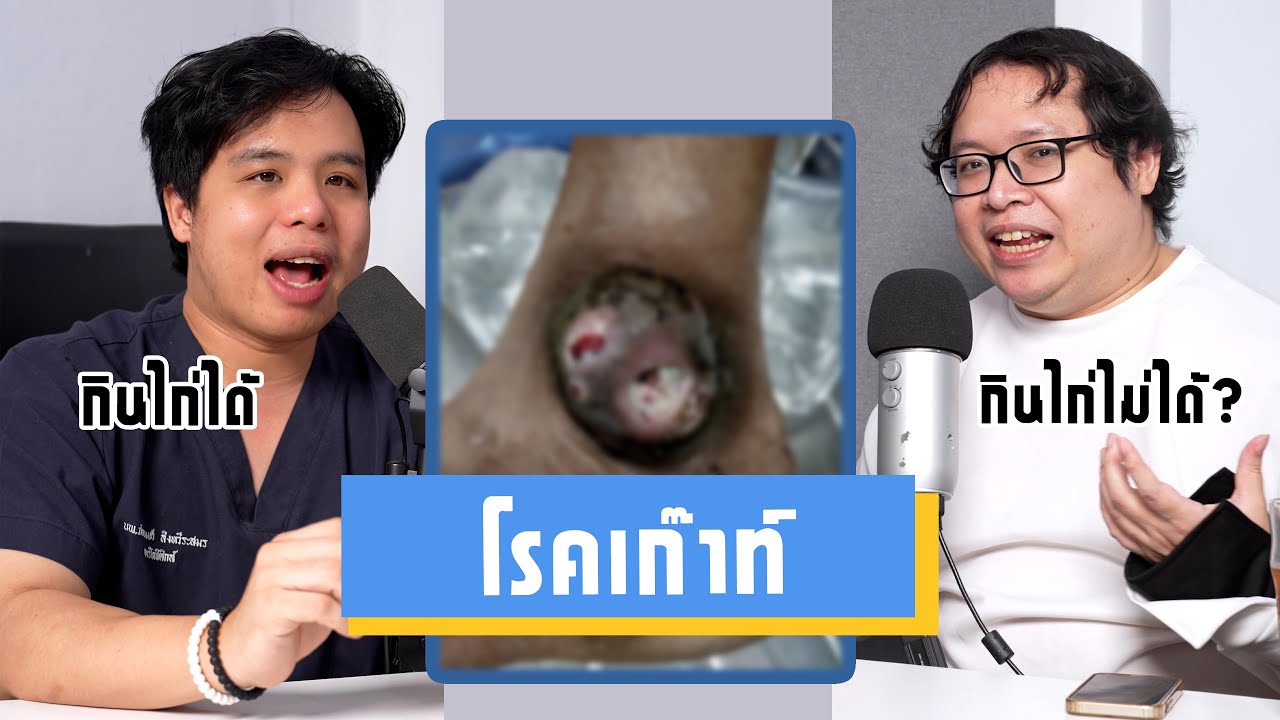 เมื่อหมอกระดูกเป็นเก๊าท์ เขาดูแลตัวเองยังไง || เป็นไรคลับPodcast EP.07 