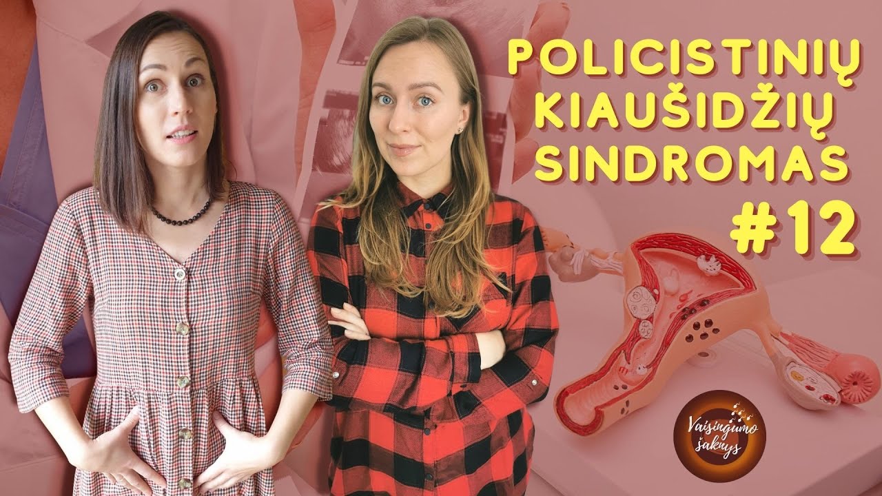 Policistinių kiaušidžių sindromas (PKS) | Vaisingumo Šaknys #12