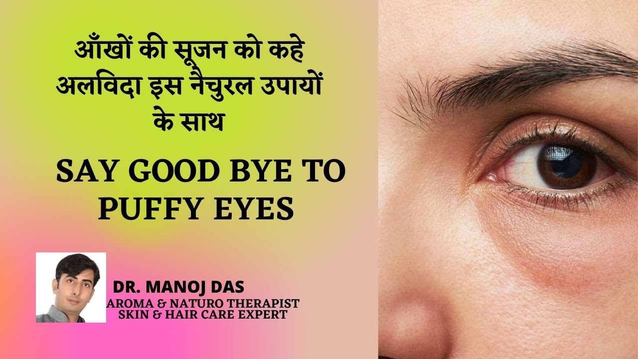 आँखों की सूजन को कहे अलविदा इस नैचुरल उपायों के साथ I SAY GOOD BYE TO PUFFY EYES  I DR. MANOJ DAS