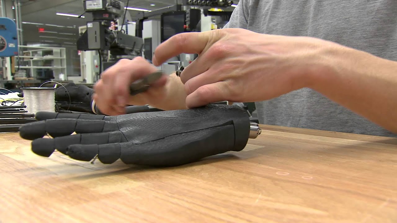Printable Prosthetic Hand
