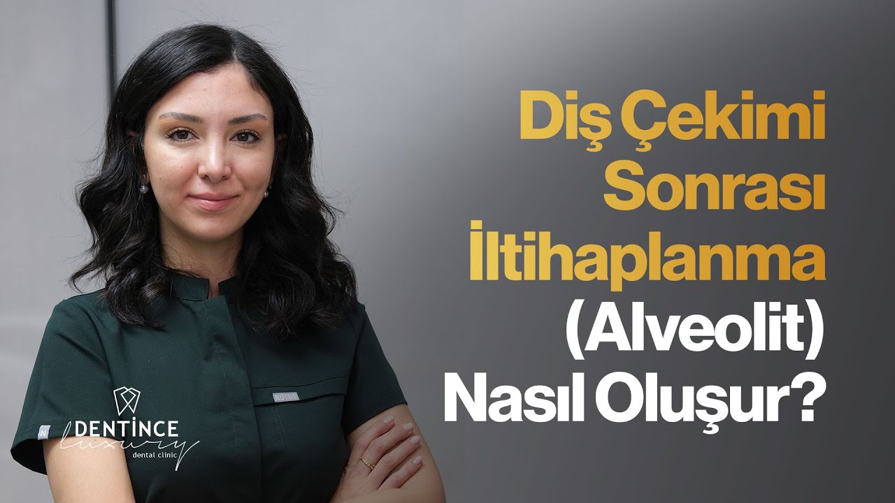 Diş Çekimi Sonrası İltihaplanma (Alveolit) Nasıl Oluşur?