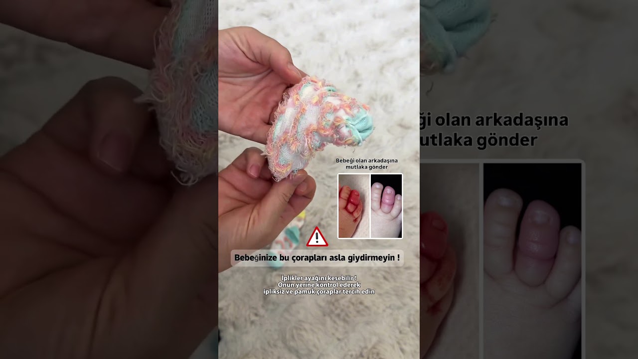 Dikkat edilmesi gereken &ouml;nemli bir konu ! #bebek #bebekbakımı #anne #annebebek #newborn #yenidoğan