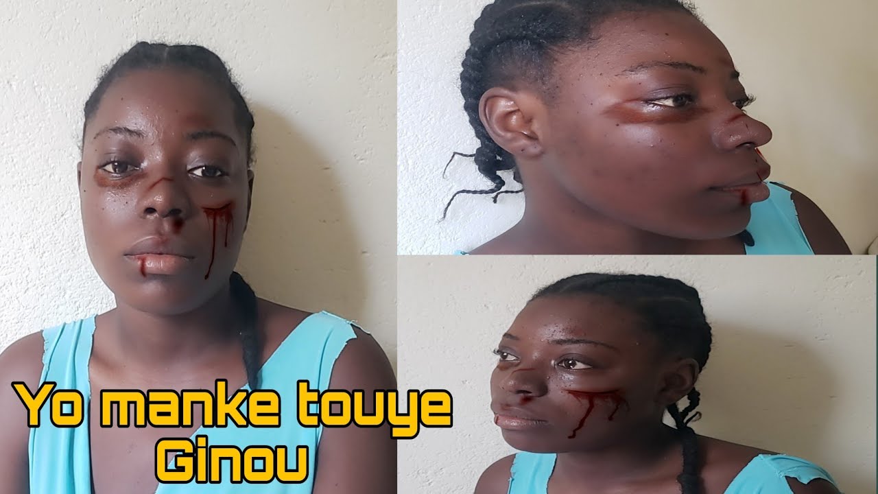 Da_G nan gwo problème vòlè manke touye ginou pandan li pral fè mache 😭😭😭😭😭😭😭😭