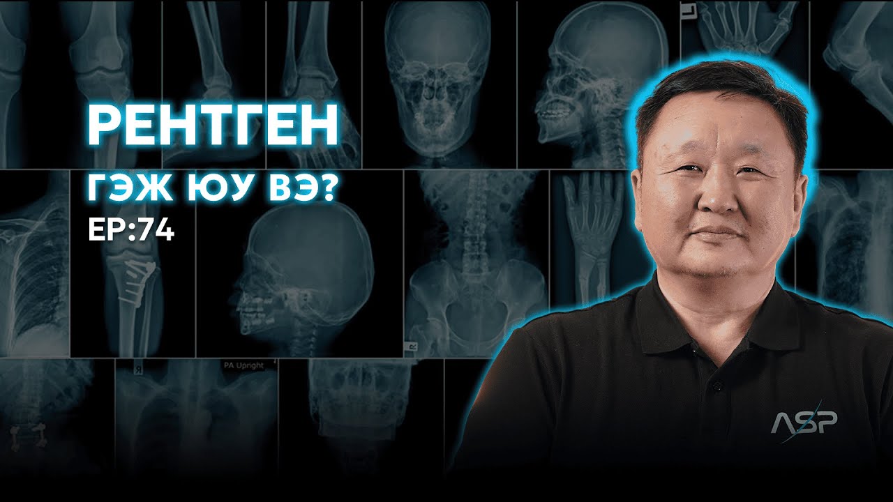 🔍 ШУ-ны хялбаршуулсан нийтлэл Ep : 74 | Рентген туяаг тайлбарлах нь | ФУ-ны Доктор, Норовын Тэгшбаяр