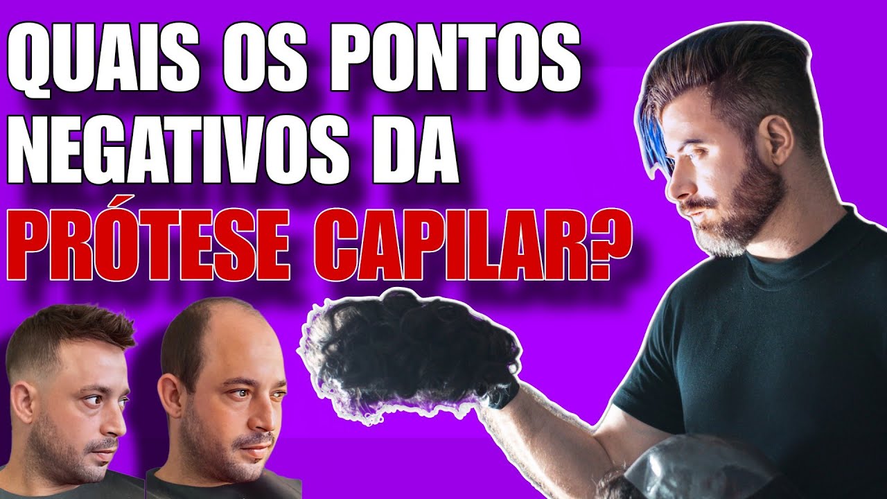 Quais Os Pontos Negativos Da Prótese Capilar  | Barbearia Super Barba BH |