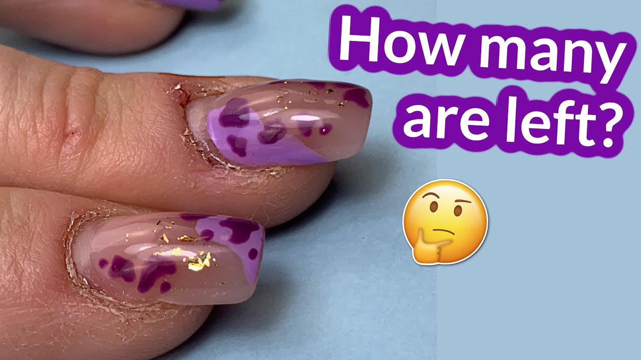 Двойные формы на обгрызенных ногтях — надолго ли? Преображение Anna Nails