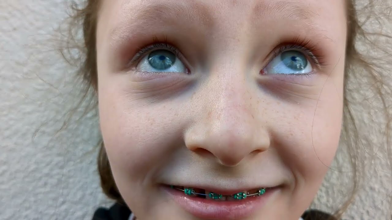 Clip Capucine (Zaz) par Toul ar C'hoat Epilepsies