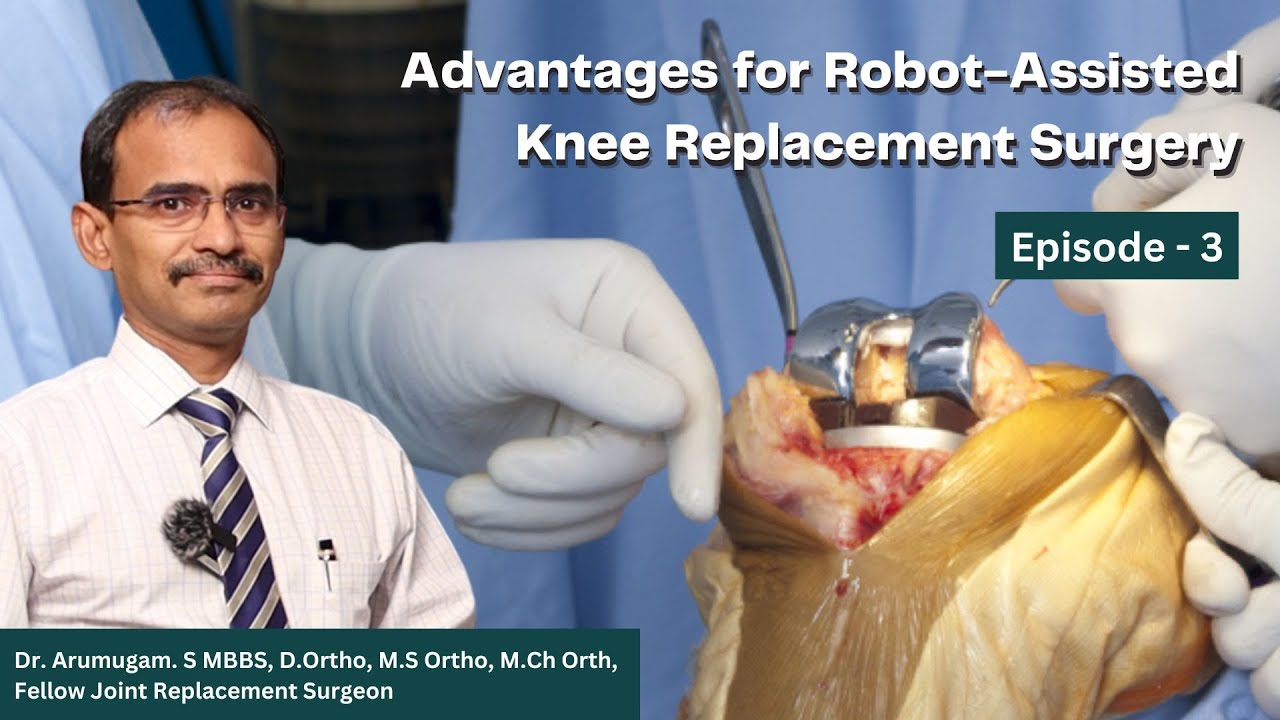 Advantages for Robot-Assisted Knee Replacement Surgery | Doctor Arumugam | Prashanth Hospitals