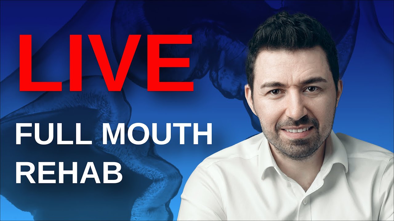 Full mouth rehab: livestream with Maxim Belograd