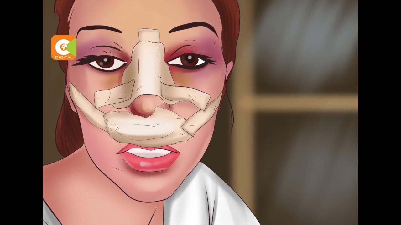 More Kenyans undergoing plastic surgery