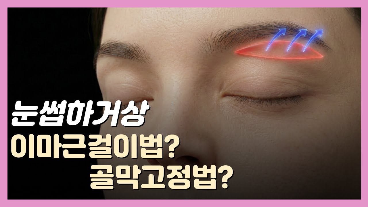 눈썹하거상 수술 오래 가려면? 꼭 알아야 할 고정 방식 비교