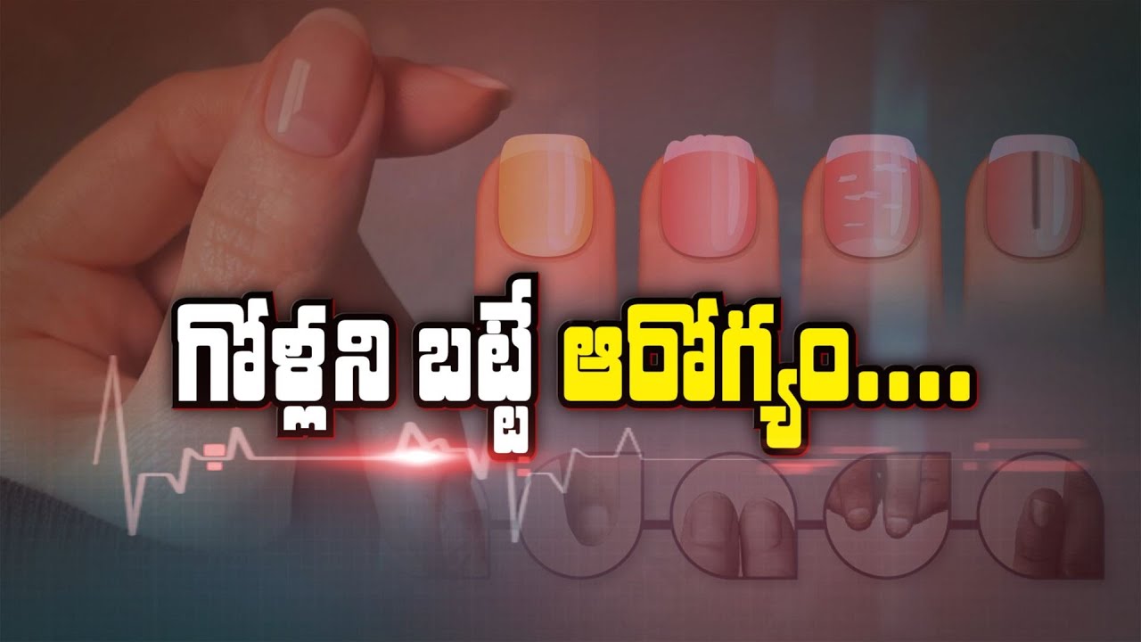 గోళ్లను బట్టే ఆరోగ్యం | Nails are the Indicators of Health | Sukhibhava | ETV Life