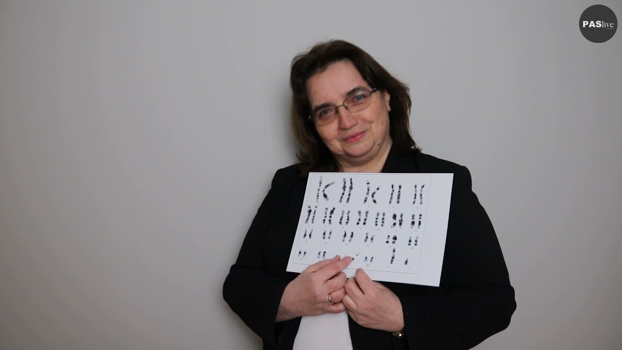 Światowy dzień zespołu Downa wraz z TRISO