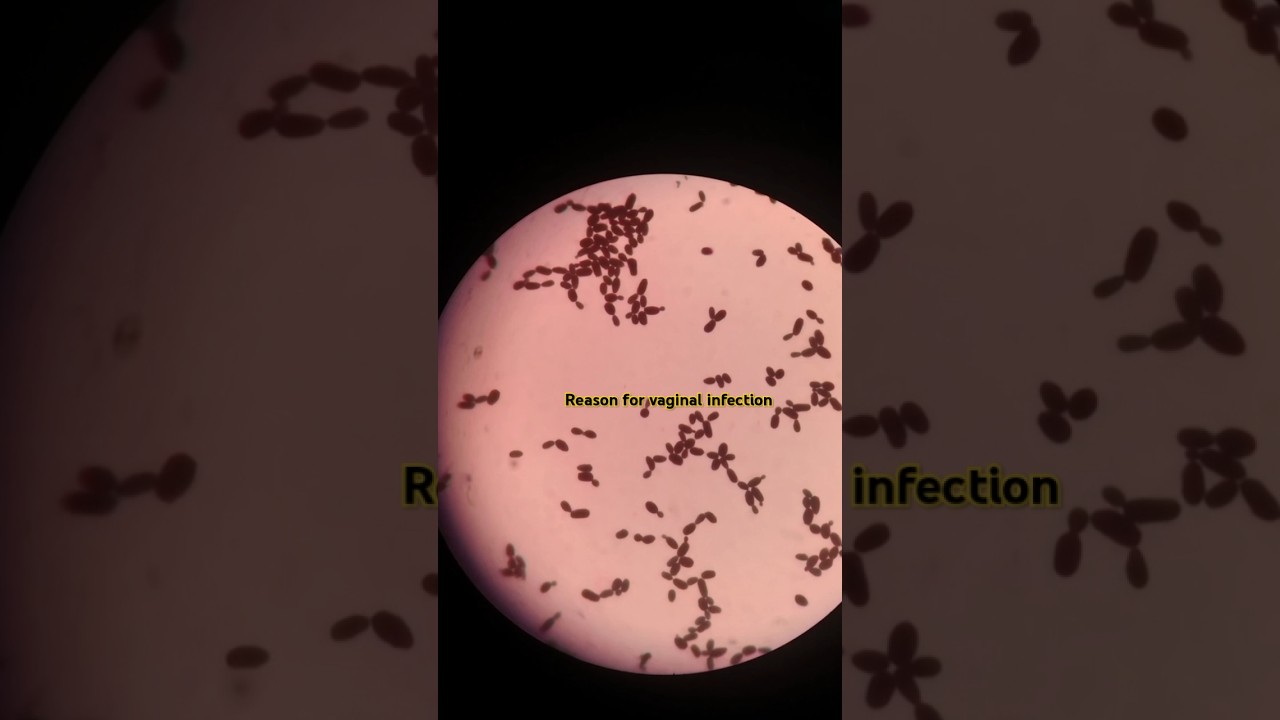 “A microscopic look at the fungus responsible for Candida infection#Microbiology#science #LabLife