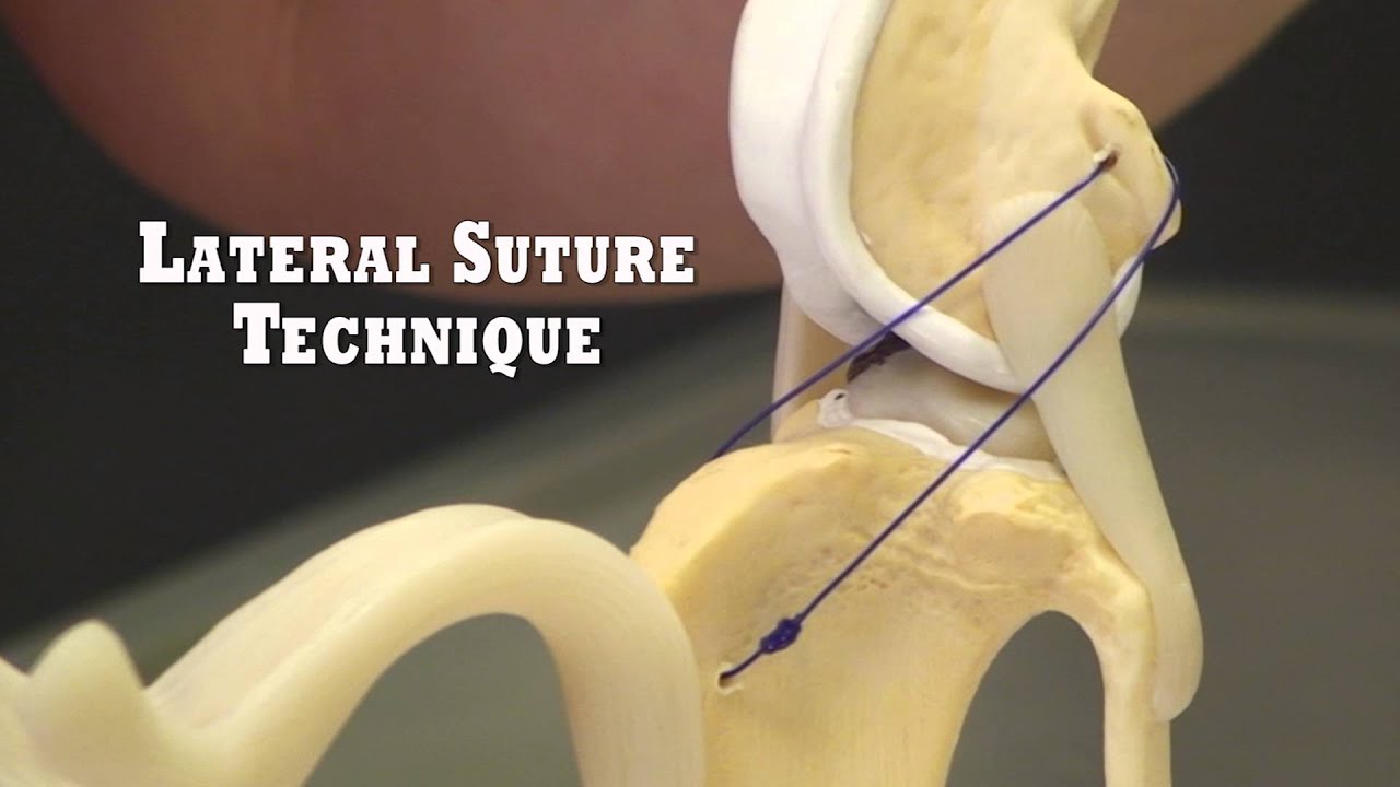 Torn ACL in Dogs - Surgery to Repair the Cranial Cruciate Ligament