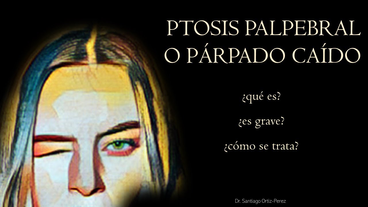 Ptosis Palpebral o Párpado Caído