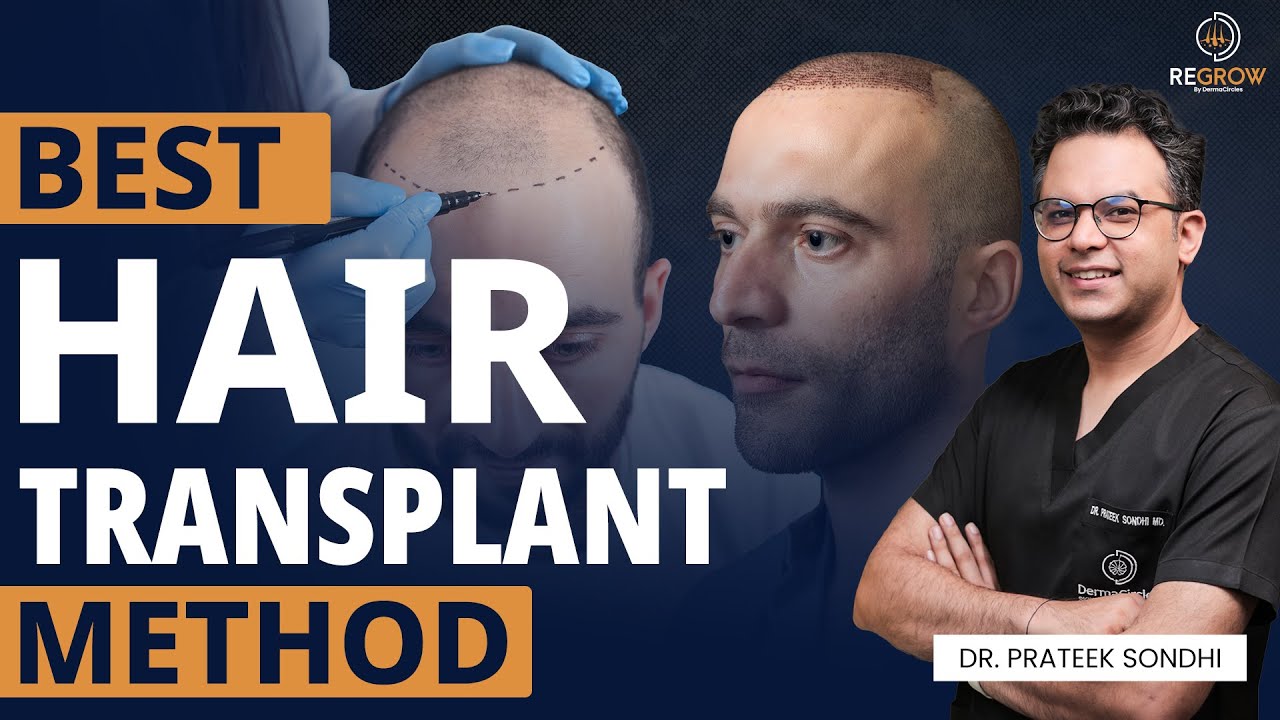 FUE vs FUT vs DHI &ndash; Which Hair Transplant is Right for You? | Dr. Prateek Sondhi | Derma Circles