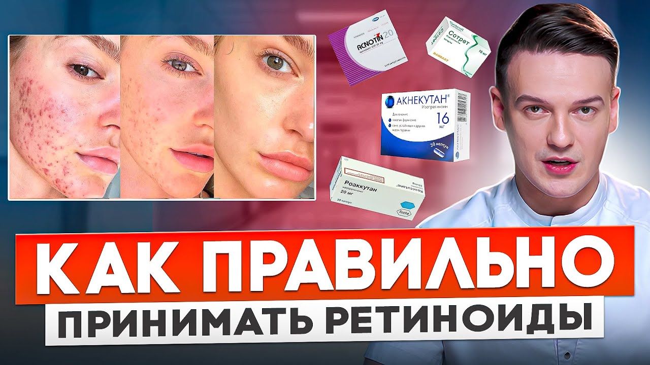 Самое эффективное средство при лечении прыщей