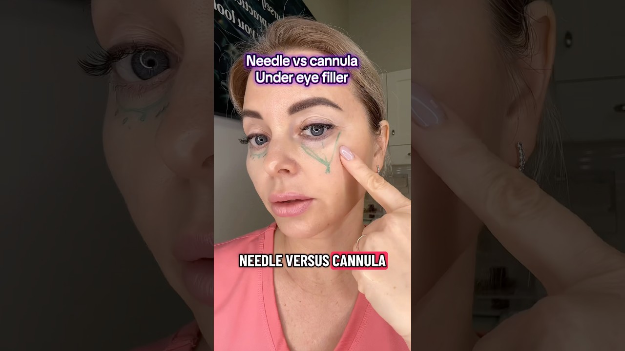 Needle vs Cannula technique for under eyes filler