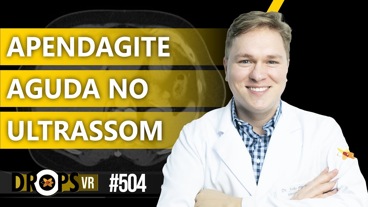 ACHADOS DA APENDAGITE AGUDA NO ULTRASSOM