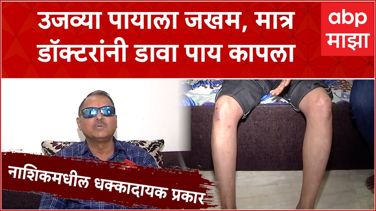 Nashik Leg Surgery : उजव्या पायाला जखम,डॉक्टरने चुकून डावा पाय कापला, डॉक्टरच्या चुकीमुळे पेशंट अधु