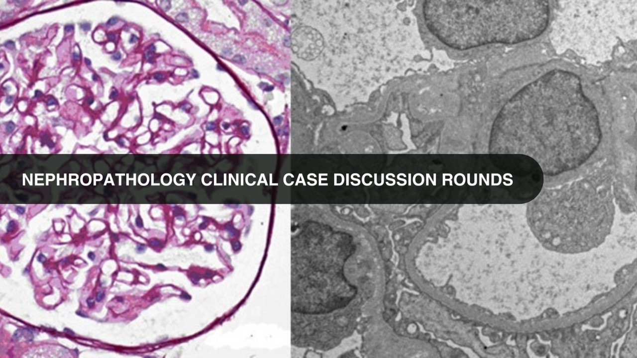 2026.02.17 Nephropathology Clinical Case Discussion Rounds